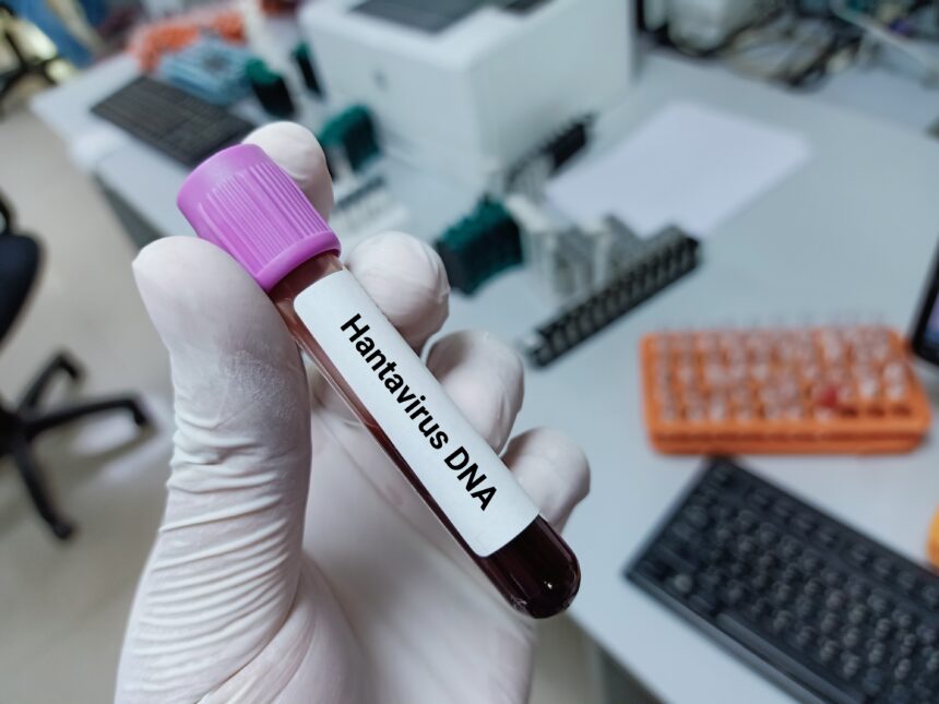 WHO says there is no reason for the hantavirus outbreak to become a major epidemic