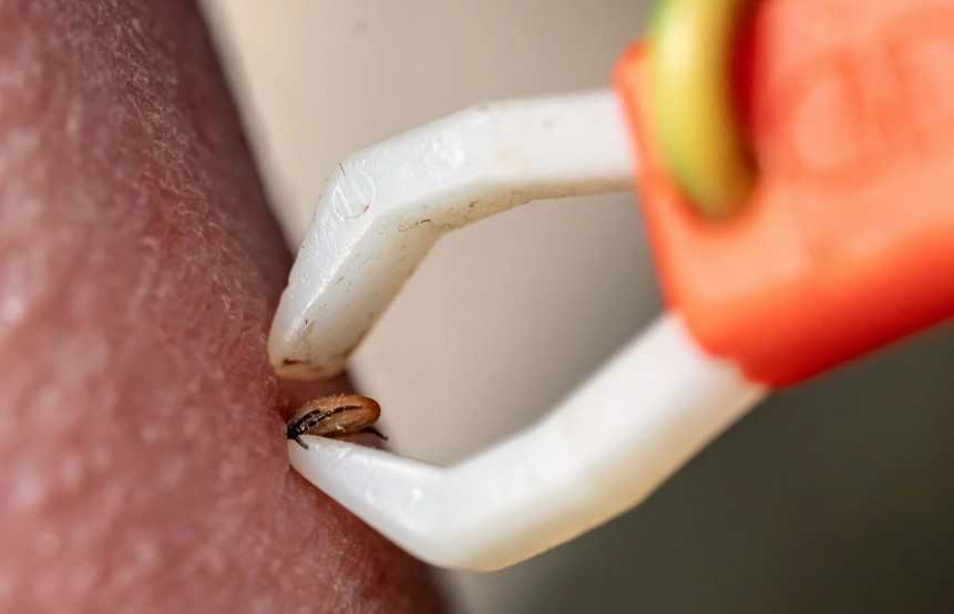 A rare tick-borne disease is on the rise A rare tick-borne disease is on the rise